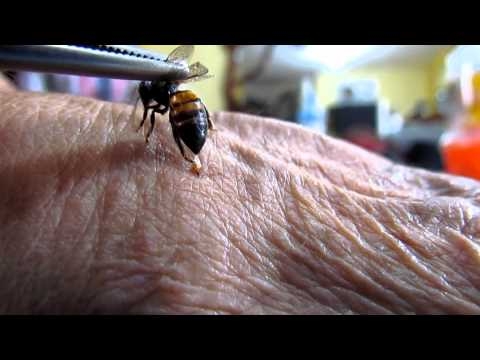 El Veneno de la Abeja potencia el Sistema Inmunologico de las Personas